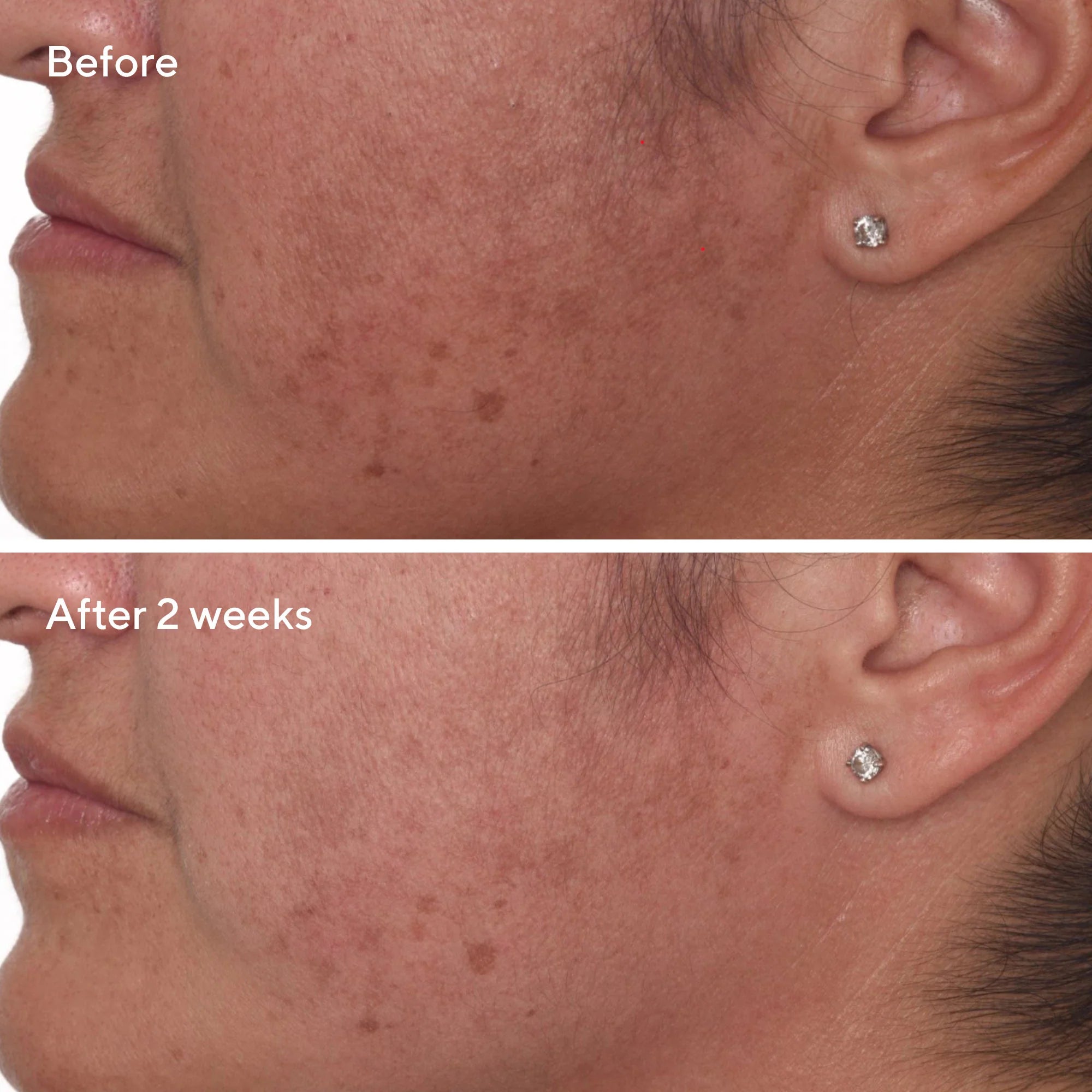 Rapid Dark Spot Correcting Serum