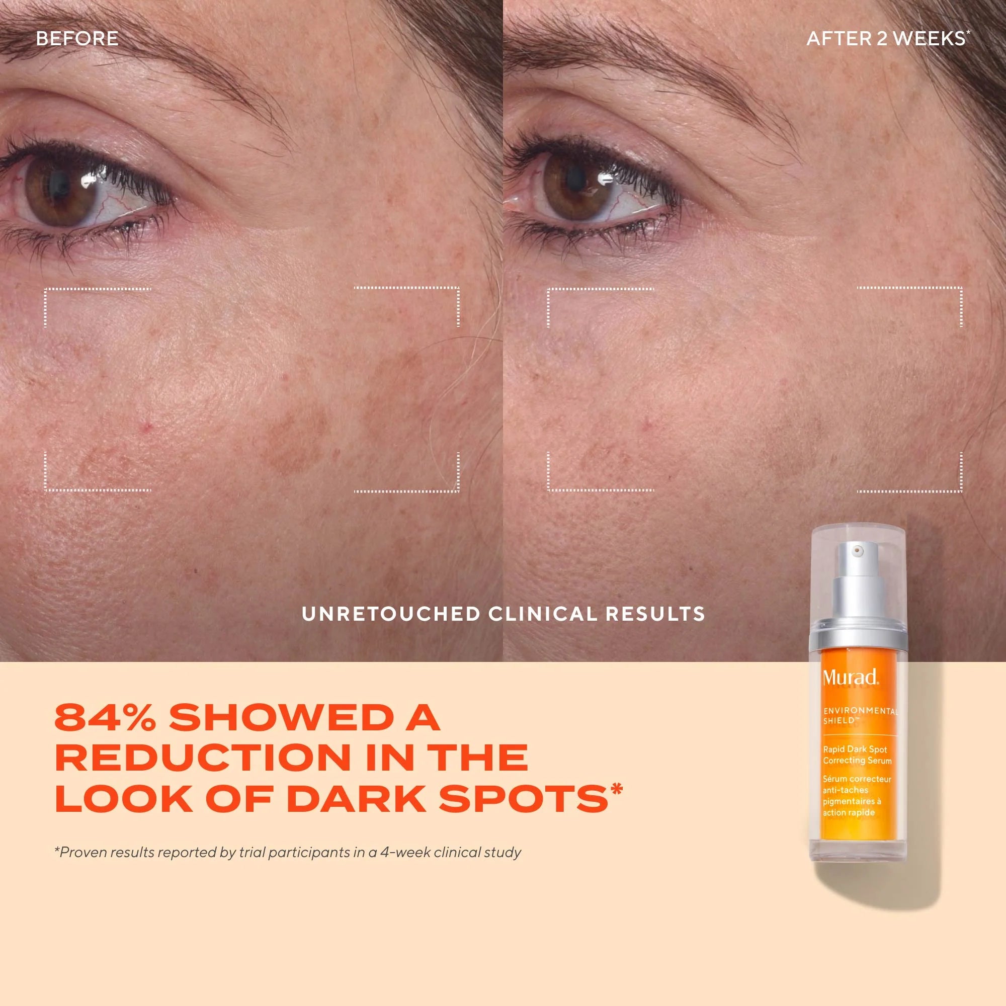 Rapid Dark Spot Correcting Serum